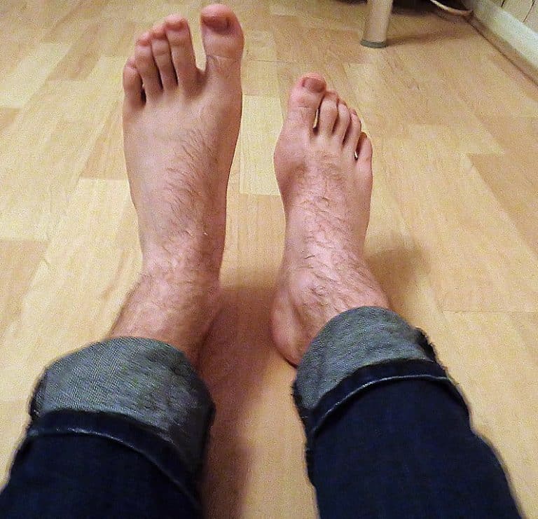 Are there special shoes for drop foot? 1 796px Foot drop